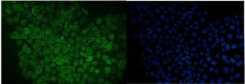 RANGAP1 Rabbit Polyclonal Antibody