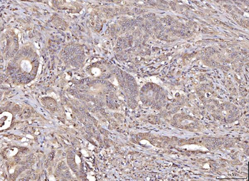 RANGAP1 Rabbit Polyclonal Antibody