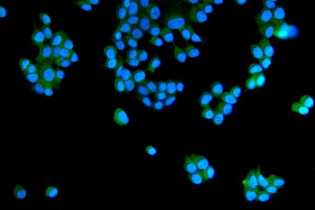 RAB5A/B/C Rabbit Polyclonal Antibody