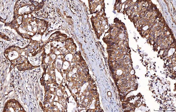 RAB5A/B/C Rabbit Polyclonal Antibody