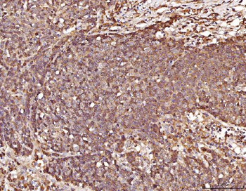 RAB5A/B/C Rabbit Polyclonal Antibody
