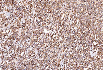 RAB5A/B/C Rabbit Polyclonal Antibody