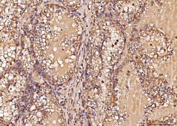 RAB5A/B/C Rabbit Polyclonal Antibody