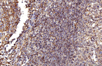 RAB5A/B/C Rabbit Polyclonal Antibody