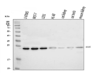 RAB5A/B/C Rabbit Polyclonal Antibody