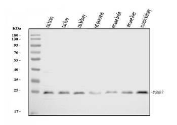 Proteasome 20S beta 7/PSMB7 Rabbit Polyclonal Antibody