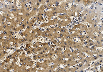 Proteasome 20S beta 7/PSMB7 Rabbit Polyclonal Antibody
