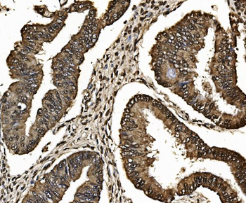 Proteasome 20S beta 7/PSMB7 Rabbit Polyclonal Antibody