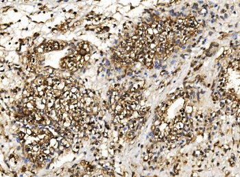 Proteasome 20S beta 7/PSMB7 Rabbit Polyclonal Antibody