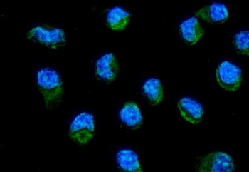ND6/MT-ND6/MT Rabbit Polyclonal Antibody