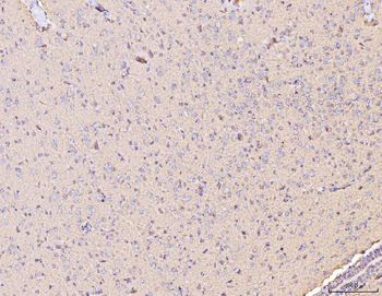 MT-CO2/MT Rabbit Polyclonal Antibody