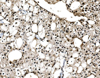 c-Jun/JUN Rabbit Polyclonal Antibody