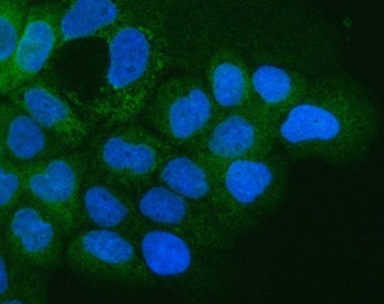 Integrin alpha 3/ITGA3 Rabbit Polyclonal Antibody