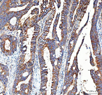 Integrin alpha 3/ITGA3 Rabbit Polyclonal Antibody