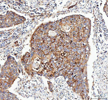 Integrin alpha 3/ITGA3 Rabbit Polyclonal Antibody
