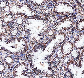 Integrin alpha 3/ITGA3 Rabbit Polyclonal Antibody