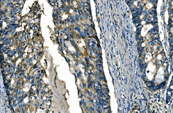FGF4 Rabbit Polyclonal Antibody