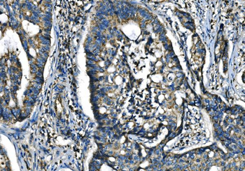 CX3CR1 Rabbit Polyclonal Antibody