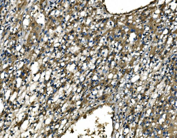 CX3CR1 Rabbit Polyclonal Antibody