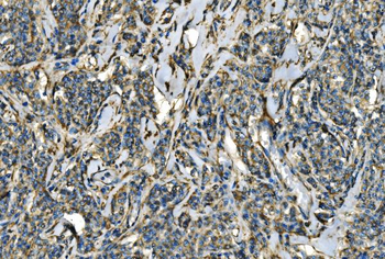 CX3CR1 Rabbit Polyclonal Antibody