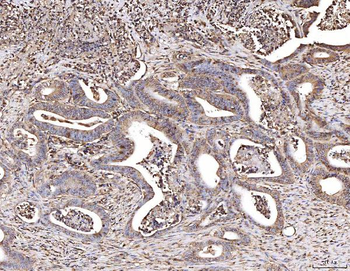 CBL Rabbit Polyclonal Antibody
