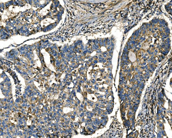 Apelin/APLN Rabbit Polyclonal Antibody