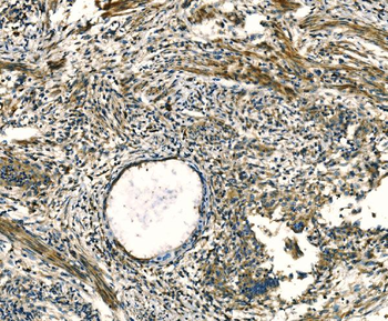 Apelin/APLN Rabbit Polyclonal Antibody