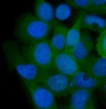 AHA1/AHSA1 Rabbit Polyclonal Antibody
