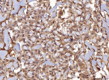 AHA1/AHSA1 Rabbit Polyclonal Antibody