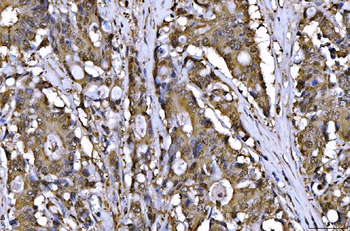 AHA1/AHSA1 Rabbit Polyclonal Antibody