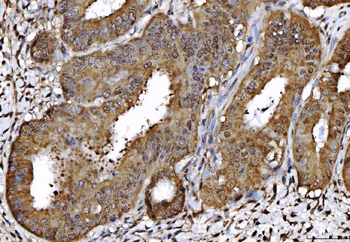 AHA1/AHSA1 Rabbit Polyclonal Antibody