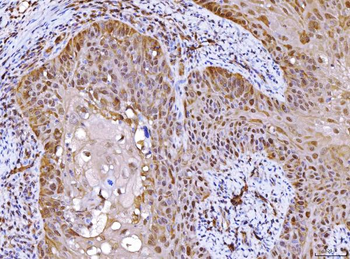 AHA1/AHSA1 Rabbit Polyclonal Antibody