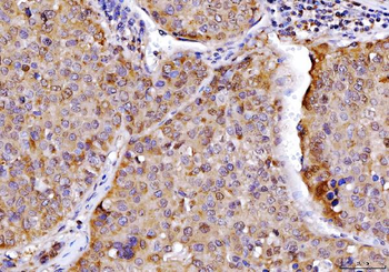 AHA1/AHSA1 Rabbit Polyclonal Antibody