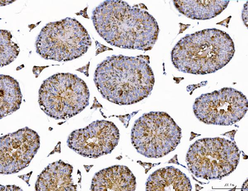 AHA1/AHSA1 Rabbit Polyclonal Antibody