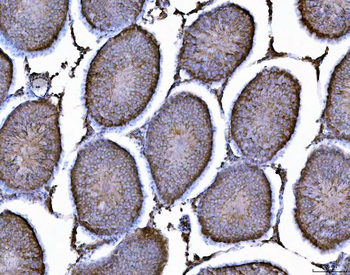 AHA1/AHSA1 Rabbit Polyclonal Antibody