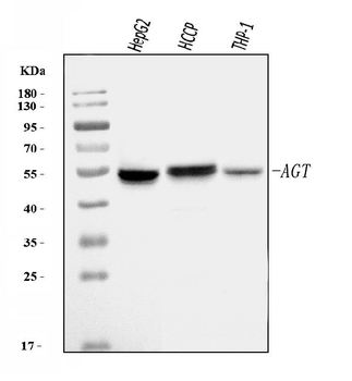 Angiotensinogen/AGT Rabbit Polyclonal Antibody
