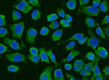 ACADM/MCAD Rabbit Polyclonal Antibody