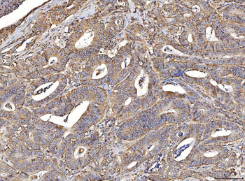 ACADM/MCAD Rabbit Polyclonal Antibody