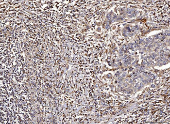 ACADM/MCAD Rabbit Polyclonal Antibody