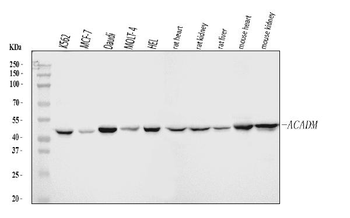 ACADM/MCAD Rabbit Polyclonal Antibody