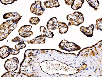PDIA6 Mouse Monoclonal Antibody