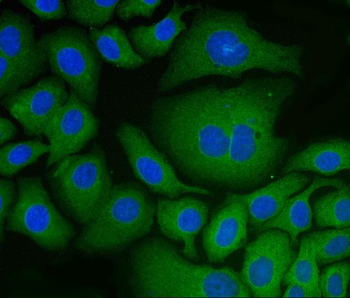 PDIA6 Mouse Monoclonal Antibody