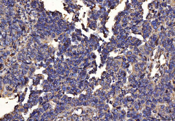 PDIA6 Mouse Monoclonal Antibody