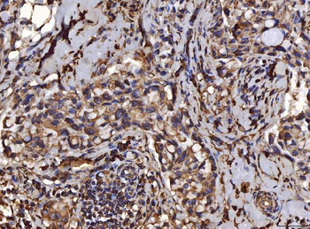 PDIA6 Mouse Monoclonal Antibody