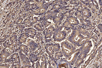 PDIA6 Mouse Monoclonal Antibody