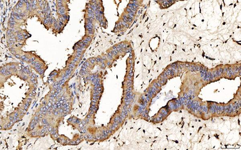 PDIA6 Mouse Monoclonal Antibody