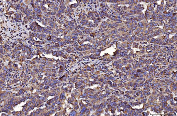 PDIA6 Mouse Monoclonal Antibody