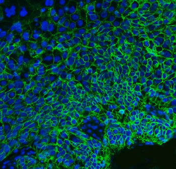 CD147/Emmprin Mouse Monoclonal Antibody