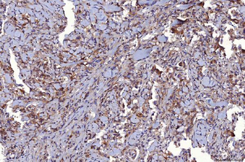 CD147/Emmprin Mouse Monoclonal Antibody