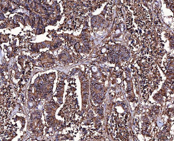 CD147/Emmprin Mouse Monoclonal Antibody